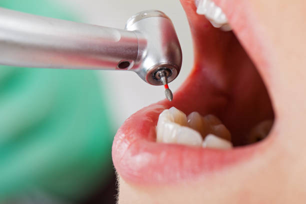 Best Tooth Infection Emergency Dentist  in Whitewater, KS